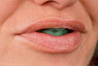 Bild03 Bild03